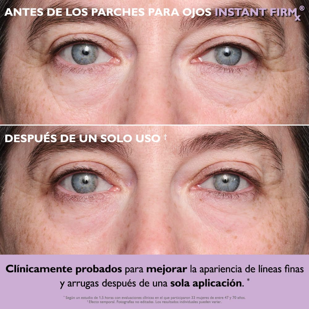 EYE PATCH + GO (SET DE MASCARILLAS PARA OJOS)